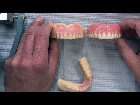 Getting Dentures Young Georgetown NY 13129